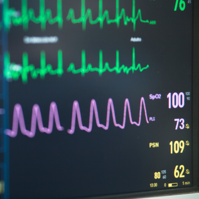 6 Essential Reasons Electrocardiographs are Transforming Modern Cardiac Care in Clinics