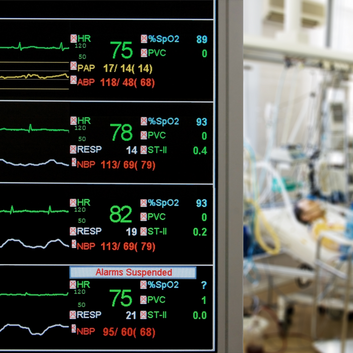 4 Key Insights for Transforming Clinic Operations with Advanced Patient Monitoring Systems