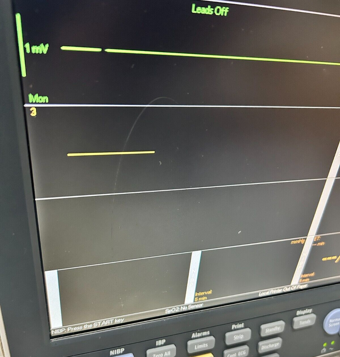 Mindray Datascope Passport V w/ CO2, NiBP, Temp, EKG, Printer 30 Day Warranty
