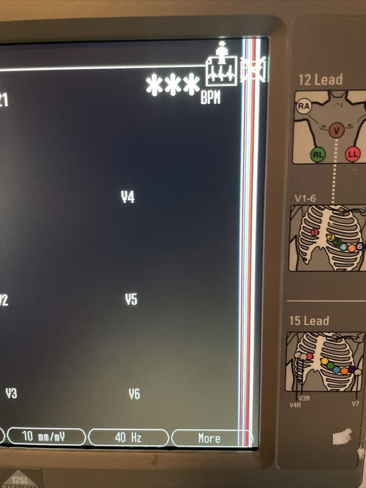 Ge Mac 5500 Parts Unit Lines In Screen Missing Button